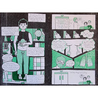 The Full Story Of My Top Surgery