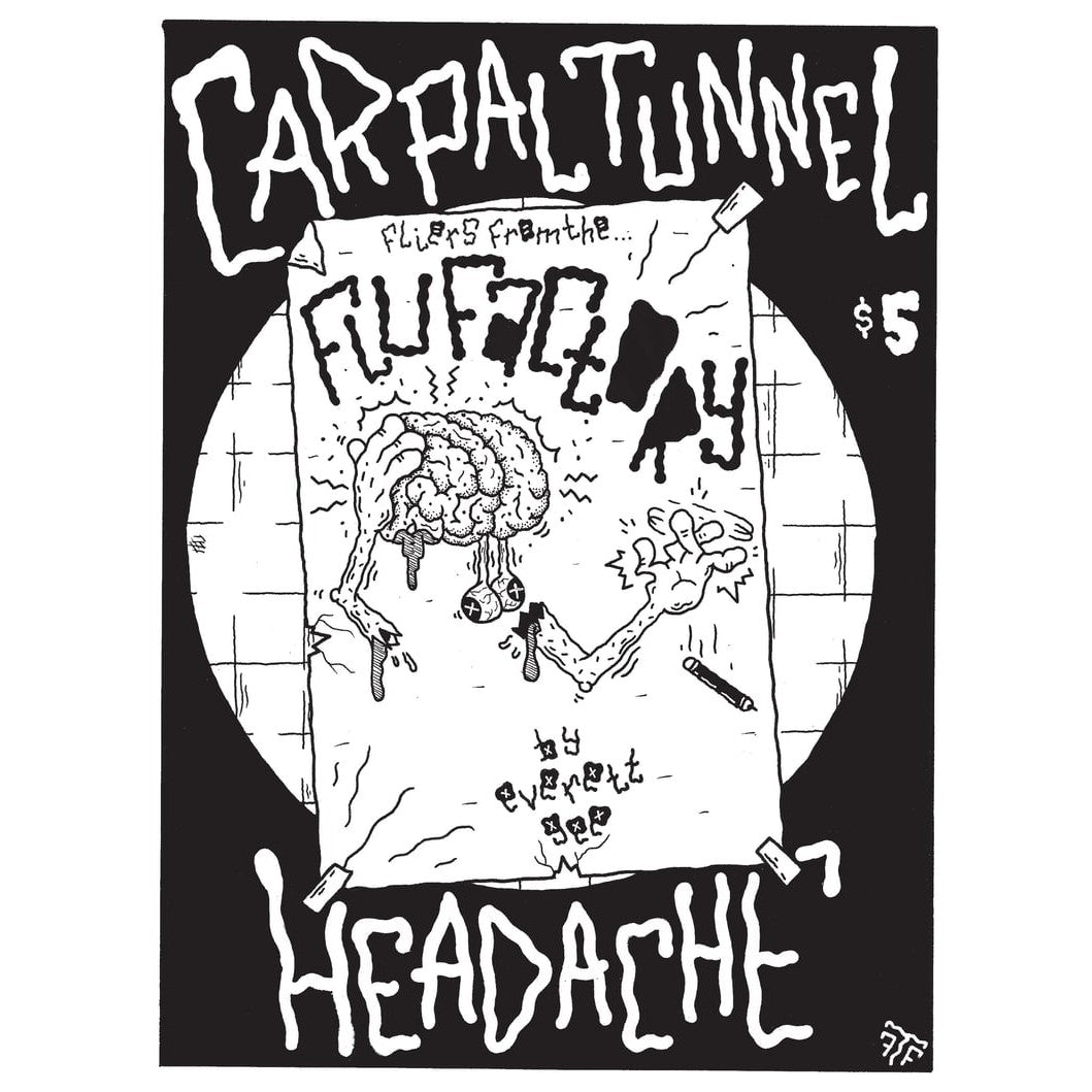Carpal Tunnel Headache