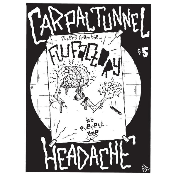 Carpal Tunnel Headache