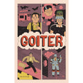 Goiter