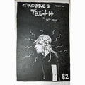 Crooked Teeth #1