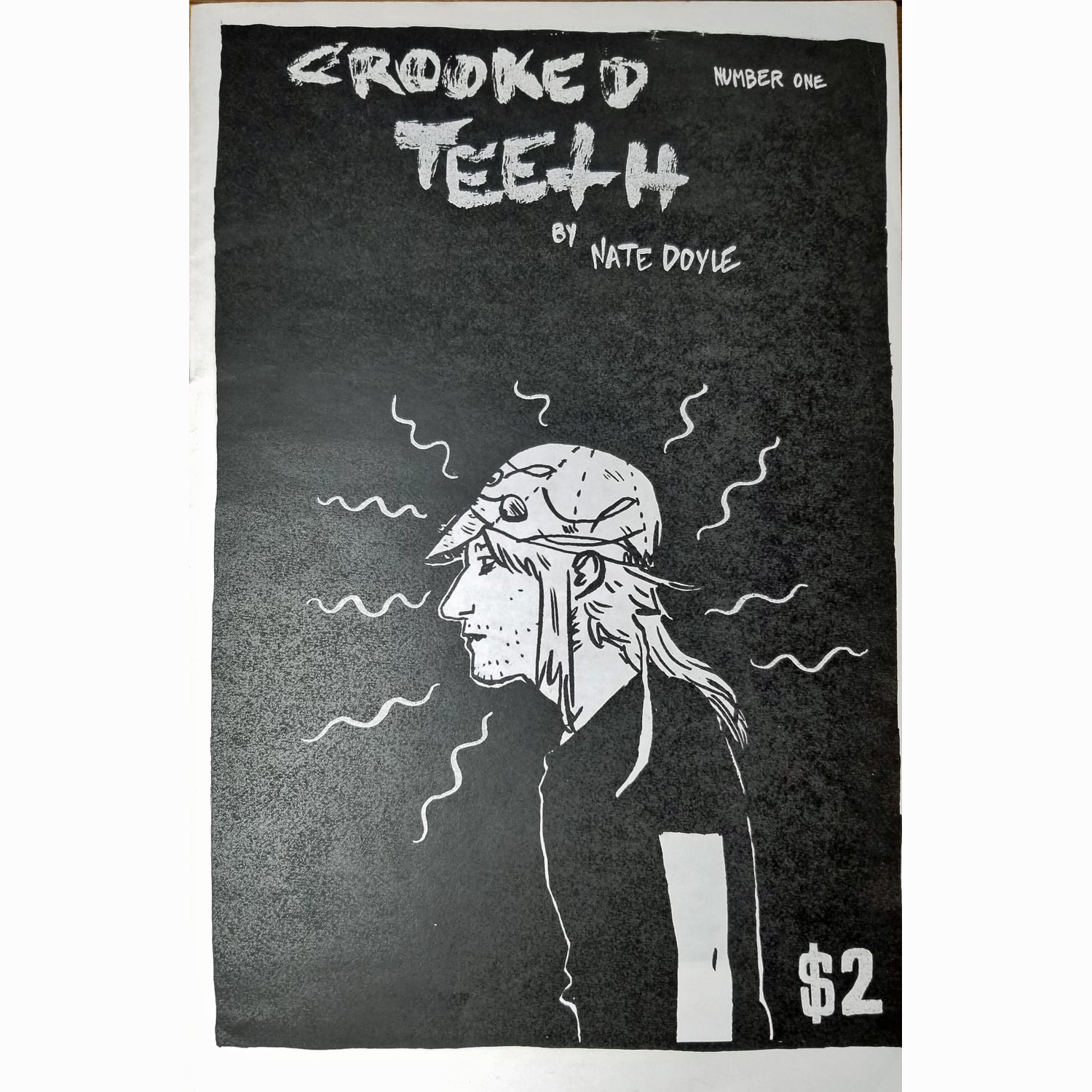 Crooked Teeth #1