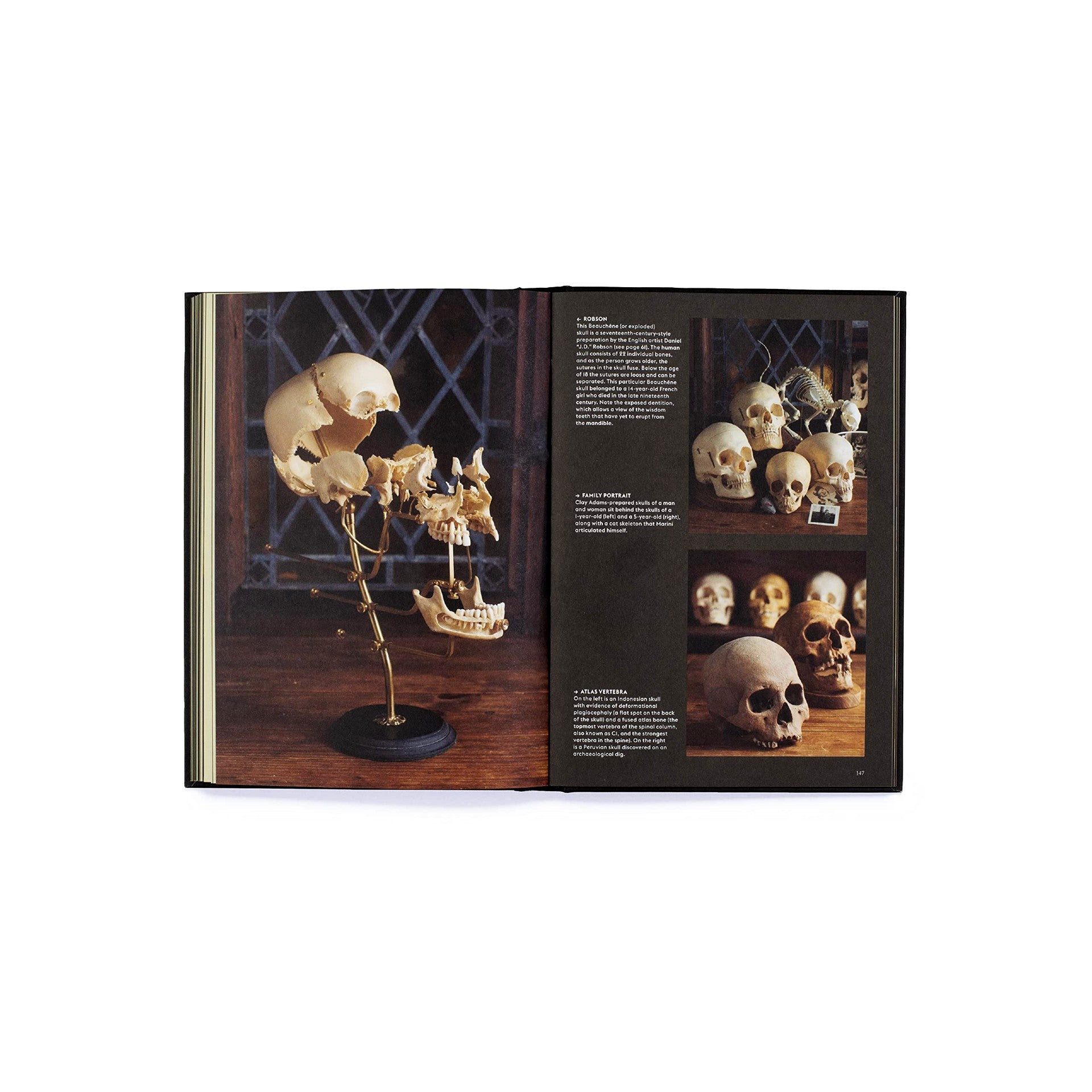 Skulls: Portraits of the Dead and the Stories They Tell